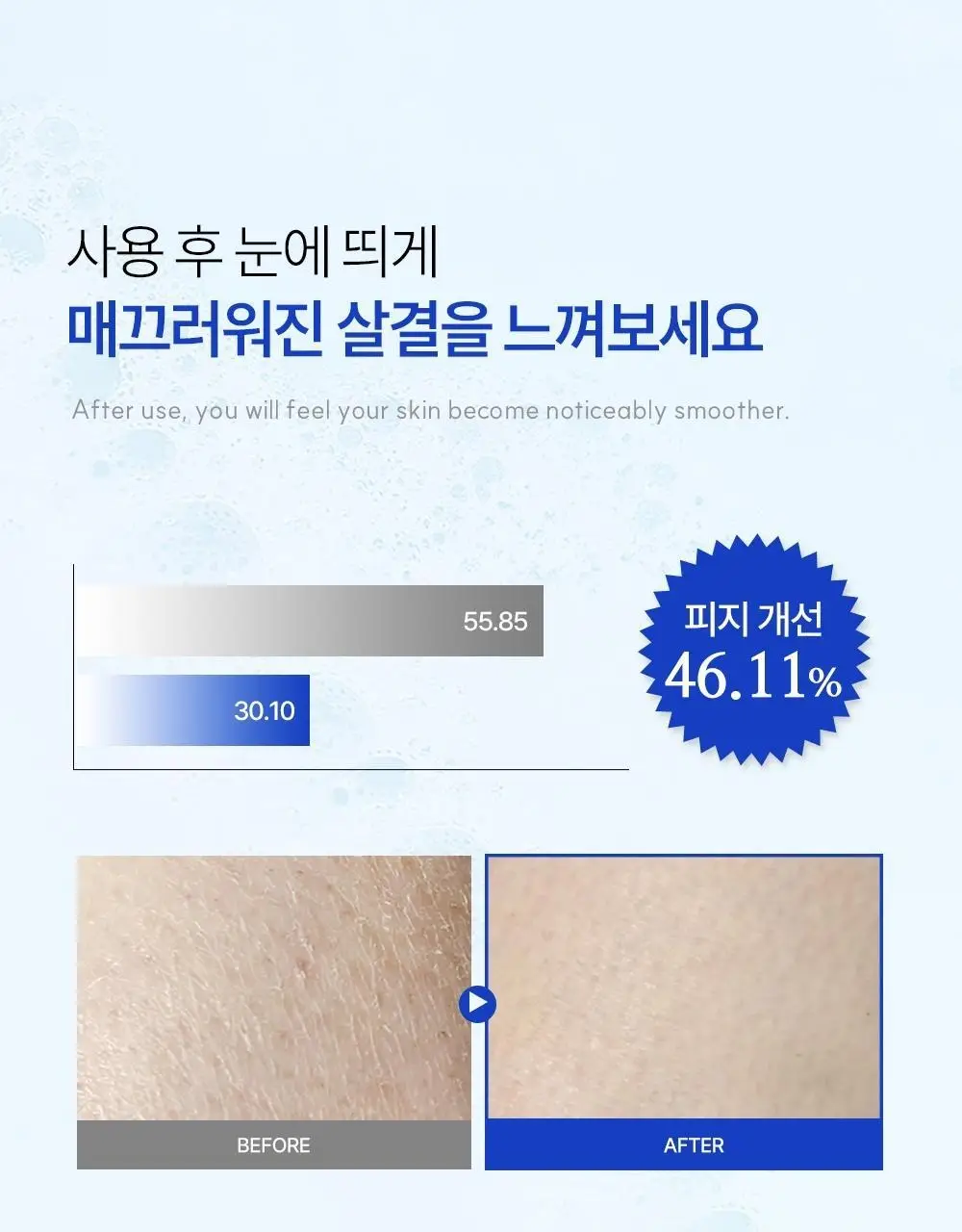 [트러블 흔적 7일개선] 오프온 등드름 바디워시(유수분밸런스케어) 상세페이지 34